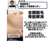 ダツモ 新宿御苑店(DATUMO)/メンズ脱毛体験談/新宿/ヒゲ脱毛