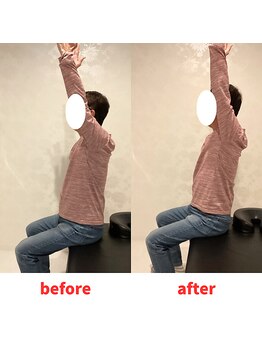 ナオル整体 福岡香椎院(NAORU整体)/60代男性施術事例【猫背】