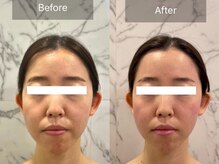 エーアイビューティー 柏店(Ai Beauty)/ 【フェイシャル例】