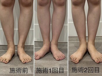 トータルビューティ リライフ(Total beauty Relife)/ウルトランス６０分下半身