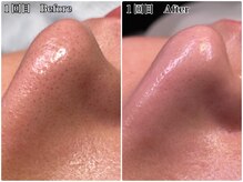 エミマス ボーテ(Emimas Beaute’)の雰囲気(毛穴洗浄で繰り返す毛穴悩みとさよなら!つまり、黒ずみに◯)