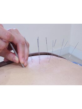 首・肩のつらさを改善したい