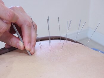 せせらぎ鍼灸院の写真/【よもぎ蒸し&ルート鍼灸】15種類のよもぎブレンドからお悩み・症状に合わせてご提案いたします