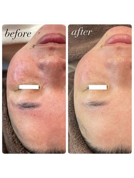 ラディエンス 多治見店/リアボーテマーメイドセルエステ