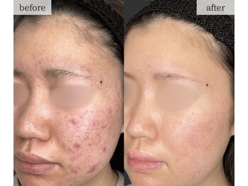 スリリアン 銀座/★お客さまビフォーアフター