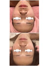 ロゼブランシュ(Rose Blanche)/