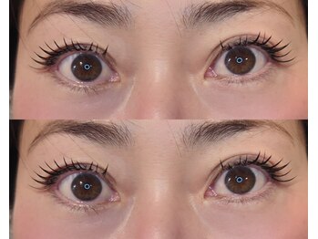 ネオリーブサイン(Neolive sign)/バインドロック100束