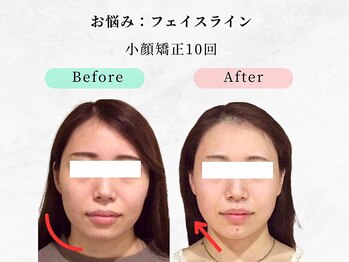美容整体 ウェリナ 蟹江院/小顔矯正/骨盤矯正/痩身整体