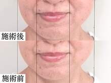 ワト(WATO)の雰囲気(美容鍼&小顔矯正はたるみ・リフトアップ効果◎)