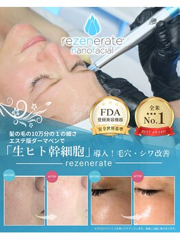 マリナビューティーサロン(Malina BEAUTY SALON)の写真/【★生ヒト幹細胞導入】毛穴レス韓国艶肌に！◎エステ版ダーマ・リゼネレートでナノレベルの肌質改善