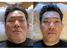 ファシア(fascia)