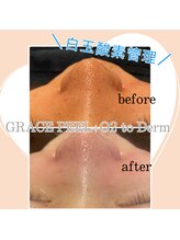 1527/韓国では定番管理