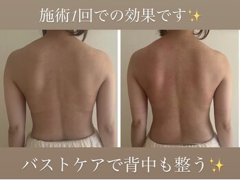 ウララカ(uraraka)/バストケアでボディラインも！