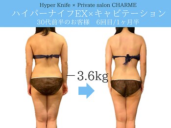 シャルム(charme)/ブライダル痩身♪ハイパーナイフ