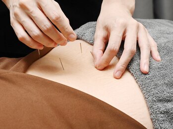 エンビューティー(EN beauty)/一番人気は美容鍼90分