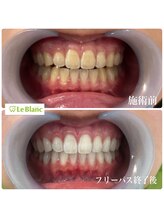 ルブラン 奈良店(Le Blanc)/がっつり白く！！