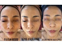 モアナ(Moana)/《オーダーメイド肌管理》