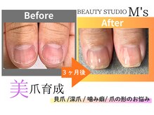 エムズ(M's)/自爪育成