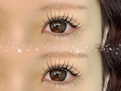 アイミー(eyeme)の写真