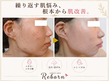 リボーン(Reborn)の写真