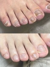 カラー(calla)/これからはフットネイルケア♪