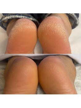 オフモード(OffMode)/これぞ！炭酸ガスパックの再生力