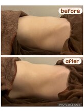 アネクル(ANECUL)/