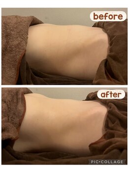 アネクル(ANECUL)/