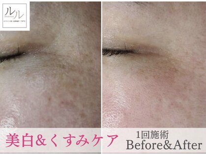 ルル 北仙台の写真