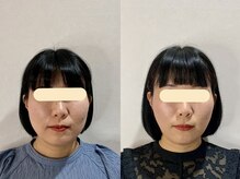 エスポワール(espoir)