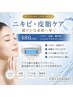 【ニキビ・皮脂ケア】触って痛いニキビや皮脂バランスにアプローチ　￥6,000