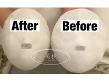 美極 トータルビューティー(美極 TOTAL BEAUTY)/恵比寿/小顔コルギ/エステ/