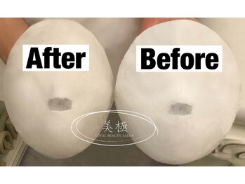 美極 トータルビューティー(美極 TOTAL BEAUTY)/恵比寿/小顔コルギ/エステ/