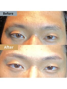 眉毛ハウス 吉祥寺店(眉毛HOUSE)/お客様の施術例(吉祥寺/東京)