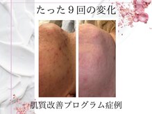 レスイズモア 恵比寿(less is more.)/30代女性 9回の変化