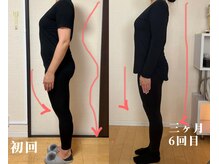 高槻 インサイド(Inside)/ビフォー・アフター