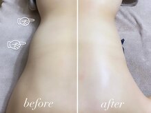 フェイン 青山店(fein.)/パワーレメディ【筋膜リリース】