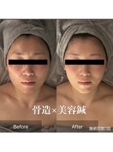 サロンリーナ 銀座店(SalonLena)/骨造×美容鍼