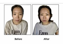 サワッディー タイリラックスマッサージ(Thai Relax Massage)/小顔になりたい