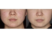 スリリアン 銀座/★お客さまビフォーアフター