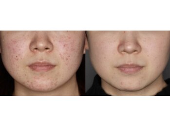 スリリアン 銀座/★お客さまビフォーアフター