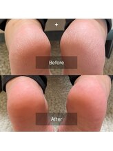 オフモード(OffMode)/あっさりとお悩み解決♪