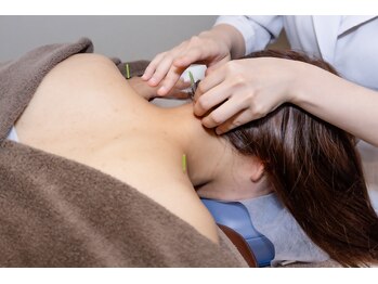 高田馬場はりきゅう院/首のコリ・重さへの鍼灸