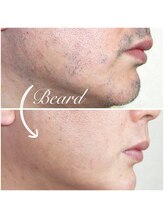 美学/いつもご来店くださるＳ様