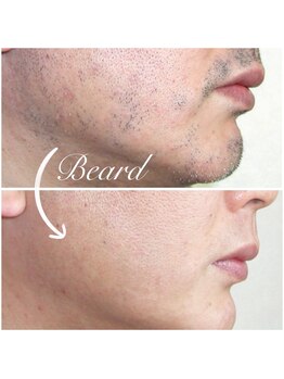 美学/いつもご来店くださるＳ様