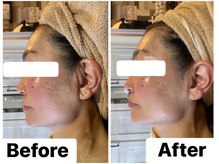 イオム ビューティワーク(IOM BEAUTY WORK)/