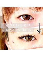 エイム(eim)/バインドロック（驚異の持続力）