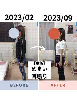 姿勢矯正院/姿勢の変化=症状の変化