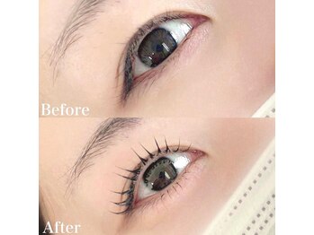 レピア 高槻店/韓国式LEPIA Before&After