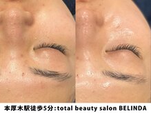 ベリンダ(BELINDA)/セルマンピーリング